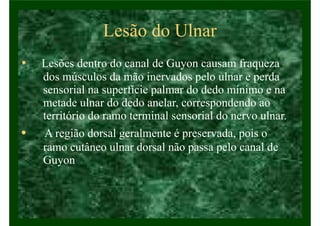 Lesão do Ulnar
• Lesões dentro do canal de Guyon causam fraqueza
dos músculos da mão inervados pelo ulnar e perda
sensorial na superfície palmar do dedo mínimo e na
metade ulnar do dedo anelar, correspondendo ao
território do ramo terminal sensorial do nervo ulnar.
• A região dorsal geralmente é preservada, pois o
ramo cutâneo ulnar dorsal não passa pelo canal de
Guyon.
 