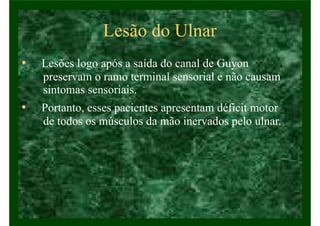 Lesão do Ulnar
• Lesões logo após a saída do canal de Guyon
preservam o ramo terminal sensorial e não causam
sintomas sensoriais.
• Portanto, esses pacientes apresentam déficit motor
de todos os músculos da mão inervados pelo ulnar.
 