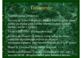 Tratamento
• Transferências Tendíneas:
• Técnica de Stiles – Bunnell : Flexor Superficial do dedo
médio ou anular para bandas laterais radiais do dedo
medio , anelar e mínimo
• Técnica de Littler : Falange proximal
• Técnica de Brand I : Extensor curto radial do carpo
estendido dorsalmente através de espaços
intermetacarpianos para bandas laterais de 4 ºe 5º dedos
• Brand II: Extensor longo radial do carpo
• Técnica de Riordan: Usando Flexor Radial do Carpo +
enxerto do M . Braquiorradial para Bandas Laterais
 