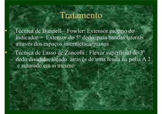 Tratamento
• Técnica de Bunnell – Fowler: Extensor próprio do
indicador + Extensor do 5º dedo para bandas laterais
através dos espaços intermetacarpianos
• Técnica de Lasso de Zancolli : Flexor superficial do 3º
dedo dividido, alçado através de uma fenda na polia A 2
e suturado em si mesmo
 