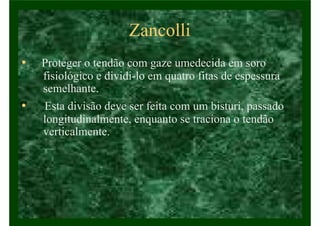 Zancolli
• Proteger o tendão com gaze umedecida em soro
fisiológico e dividi-lo em quatro fitas de espessura
semelhante.
• Esta divisão deve ser feita com um bisturi, passado
longitudinalmente, enquanto se traciona o tendão
verticalmente.
 