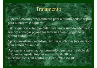 Tratamento
Repetir o mesmo procedimento para o quinto dedo e depois
para o terceiro e o quarto.
Esta seqüência é fundamental para um resultado adequado -
sempre começar pelas fitas laterais (para o segundo ou
quinto dedos).
Após hemostasia cuidadosa, suturar a pele das três incisões
com náilon 5/0 ou 6/0.
Aplicar tala gessada, posicionando o punho em flexão de
200, metacarpofalângicas em flexão de 90° e
interfalângicas em neutro de flexo-extensão (0°).
 