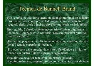 Técnica de Bunnell Brand
Faz-se uma incisão dorsolateral na falange proximal de cada um
dos quatro dedos, sempre do lado radial, com exceção do
segundo dedo, onde a incisão deve ser praticada no lado ulnar.
Em seguida, é absolutamente necessário eliminar o quiasma
tendíneo (Camper); caso contrário, não será possível retirar o
tendão na palma.
Fazer uma pequena incisão no meio da palma e retirar, através
dela, o tendão superficial liberado.
Proteger com gaze umedecida em soro fisiológico e dividir o
tendão em quatro fitas de espessura semelhante.
Esta divisão deve ser feita com um bisturi, passado
longitudinalmente, enquanto se traciona o tendão verticalmente.
 