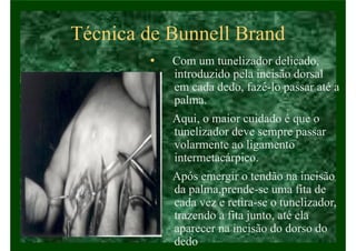 Técnica de Bunnell Brand
• Com um tunelizador delicado,
introduzido pela incisão dorsal
em cada dedo, fazê-lo passar até a
palma.
• Aqui, o maior cuidado é que o
tunelizador deve sempre passar
volarmente ao ligamento
intermetacárpico.
• Após emergir o tendão na incisão
da palma,prende-se uma fita de
cada vez e retira-se o tunelizador,
trazendo a fita junto, até ela
aparecer na incisão do dorso do
dedo
 