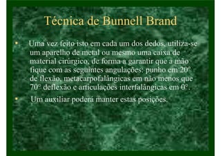 Técnica de Bunnell Brand
• Uma vez feito isto em cada um dos dedos, utiliza-se
um aparelho de metal ou mesmo uma caixa de
material cirúrgico, de forma a garantir que a mão
fique com as seguintes angulações: punho em 20º
de flexão, metacarpofalângicas em não menos que
70° deflexão e articulações interfalângicas em 0°.
• Um auxiliar poderá manter estas posições.
 