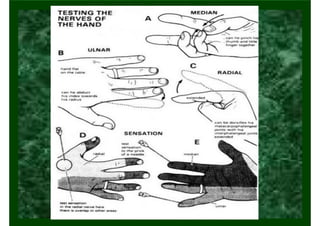 Lesão de Nervo Ulnar
