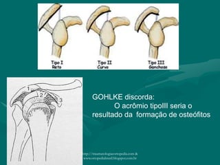 GOHLKE discorda:
O acrômio tipoIII seria o
resultado da formação de osteófitos
http://traumatologiaeortopedia.com &
www.ortopediabrasil.blogspot.com.br
 