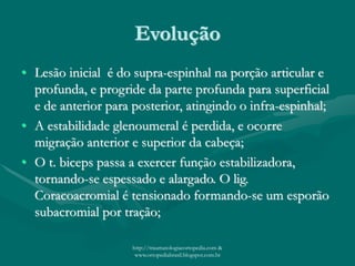 Evolução
• Lesão inicial é do supra-espinhal na porção articular e
profunda, e progride da parte profunda para superficial
e de anterior para posterior, atingindo o infra-espinhal;
• A estabilidade glenoumeral é perdida, e ocorre
migração anterior e superior da cabeça;
• O t. biceps passa a exercer função estabilizadora,
tornando-se espessado e alargado. O lig.
Coracoacromial é tensionado formando-se um esporão
subacromial por tração;
http://traumatologiaeortopedia.com &
www.ortopediabrasil.blogspot.com.br
 