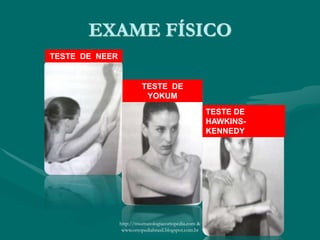 EXAME FÍSICO
TESTE DE NEER
TESTE DE
YOKUM
TESTE DE
HAWKINS-
KENNEDY
http://traumatologiaeortopedia.com &
www.ortopediabrasil.blogspot.com.br
 