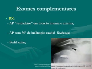 Exames complementares
• RX:
- AP “verdadeiro” em rotação interna e externa;
- AP com 30º de inclinação caudal- Rockwood;
- Perfil axilar;
http://traumatologiaeortopedia.com &
www.ortopediabrasil.blogspot.com.br
 