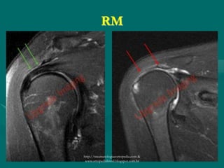 RM
http://traumatologiaeortopedia.com &
www.ortopediabrasil.blogspot.com.br
 