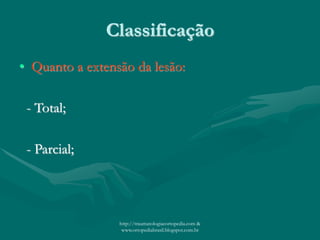 Classificação
• Quanto a extensão da lesão:
- Total;
- Parcial;
http://traumatologiaeortopedia.com &
www.ortopediabrasil.blogspot.com.br
 