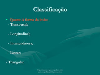 Classificação
• Quanto à forma da lesão:
- Transversal;
- Longitudinal;
- Intratendinosa;
- Linear;
- Triangular.
http://traumatologiaeortopedia.com &
www.ortopediabrasil.blogspot.com.br
 