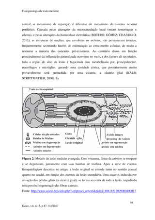 Fisiopatologia da lesão medular
93
Getec, v.6, n.13, p.87-103/2017
central, o mecanismo de reparação é diferente do mecanismo do sistema nervoso
periférico. Causada pelas alterações da microcirculação local (micro hemorragias e
edema), e pelas alterações da homeostase eletrolítica (BOTERO; GÓMEZ; CHAPARRO,
2013), as estruturas de mielina, que envolvem os axônios, não permanecem intactas,
frequentemente secretando fatores de estimulação ao crescimento axônico, de modo a
restaurar a maioria das conexões pré-existentes. Ao contrário disso, em função
principalmente da inflamação generalizada ocorrente no meio, e dos fatores ali secretados,
toda a região do sítio da lesão é fagocitada e/ou metabolizada por, principalmente,
macrófagos e micróglias, gerando uma cavidade cística, que posteriormente muito
provavelmente será preenchida por uma cicatriz, a cicatriz glial (KALB;
STRITTMATTER, 2000). Es
Figura 2: Modelo de lesão medular avançada. Com o trauma, fibras de axônios se rompem
e se degeneram, juntamente com suas bainhas de mielina. Após a série de eventos
fisiopatológicos descritos no artigo, a lesão original se estende tanto no sentido cranial
quanto no caudal, em função dos eventos da lesão secundária. Uma cicatriz, induzida por
ativação das células gliais (a cicatriz glial), se forma ao redor de toda a lesão, impedindo
uma possível regeneração das fibras axonais.
Fonte: http://www.scielo.br/scielo.php?script=sci_arttext&pid=S180818512009000400017
 