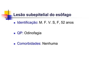 Lesão subepitelial do esôfago
 Identificação: M. F. V. S, F, 52 anos
 QP: Odinofagia
 Comorbidades: Nenhuma
 