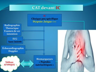 CAT devant IC
IC
Clinique peu spécifique
Dyspnée ,fatigue +++
Radiographie
Thoracique
Examen de 1er
intention
ECG
Sans intérêt
Échocardiographie
Doppler
Biomarqueurs
« Peptides
natriurétiques »intérêt
Tableau
ATYPIQUE
pronostic
 