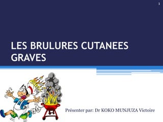 LES BRULURES CUTANEES
GRAVES
Présenter par: Dr KOKO MUNJUZA Victoire
1
 