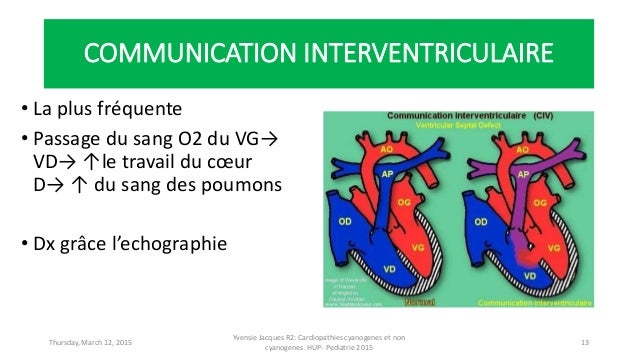 COMMUNICATION INTERVENTRICULAIRE EBOOK DOWNLOAD