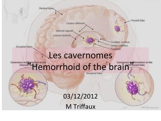 Les	cavernomes		
“Hemorrhoid	of	the	brain”	
03/12/2012	
M	Triﬀaux	
 