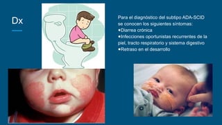 Dx
Para el diagnóstico del subtipo ADA-SCID
se conocen los siguientes síntomas:
●Diarrea crónica
●Infecciones oportunistas recurrentes de la
piel, tracto respiratorio y sistema digestivo
●Retraso en el desarrollo
 