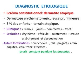 DIAGNOSTIC ETIOLOGIQUE
•   Eczéma constitutionnel: dermatite atopique
•   Dermatose érythémato vésiculeuse prurigineuse
•   3 % des enfants - terrain atopique.
•   Clinique : > 3 mois : joues – pommettes – front
• Evolution : érythème – vésicule - suintement + croute
              assèchement et desquamation
Autres localisations : cuir chevelu , plis , poignets creux
  poplités, cou, tronc et fesses .
            prurit constant pendant les poussées .
 