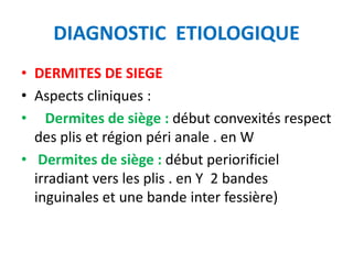 DIAGNOSTIC ETIOLOGIQUE
• DERMITES DE SIEGE
• Aspects cliniques :
• Dermites de siège : début convexités respect
  des plis et région péri anale . en W
• Dermites de siège : début periorificiel
  irradiant vers les plis . en Y 2 bandes
  inguinales et une bande inter fessière)
 