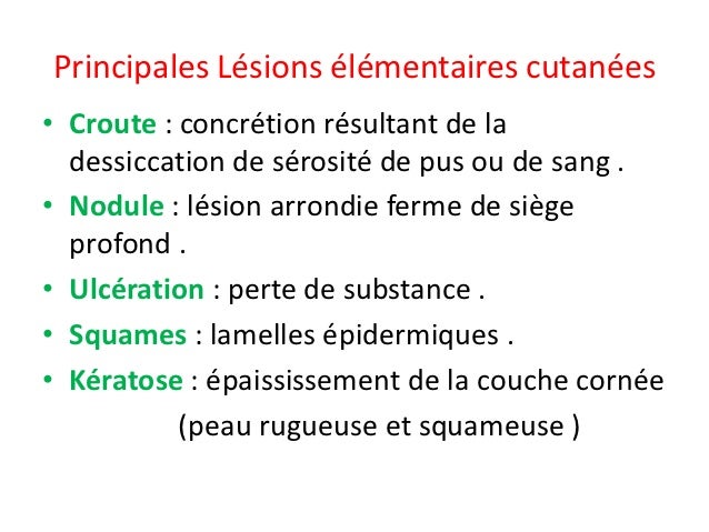 Les taches de rousseur à kalouge où se trouve