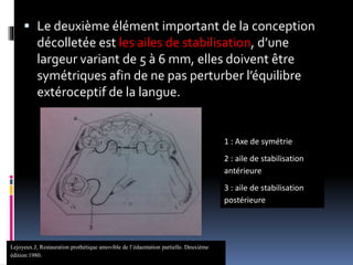  Le deuxième élément important de la conception
décolletée est les ailes de stabilisation, d’une
largeur variant de 5 à 6 mm, elles doivent être
symétriques afin de ne pas perturber l’équilibre
extéroceptif de la langue.
1 : Axe de symétrie
2 : aile de stabilisation
antérieure
3 : aile de stabilisation
postérieure
Lejoyeux.J, Restauration prothétique amovible de l’édaentation partielle. Deuxième
édition:1980.
 