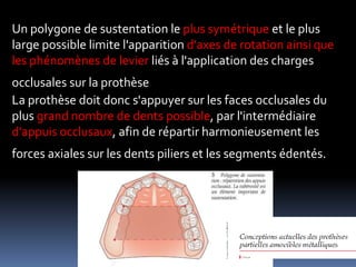 Un polygone de sustentation le plus symétrique et le plus
large possible limite l'apparition d'axes de rotation ainsi que
les phénomènes de levier liés à l'application des charges
occlusales sur la prothèse
La prothèse doit donc s'appuyer sur les faces occlusales du
plus grand nombre de dents possible, par l'intermédiaire
d'appuis occlusaux, afin de répartir harmonieusement les
forces axiales sur les dents piliers et les segments édentés.
 