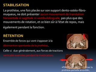 •PIERRE SANTONI: maîtriser la
prothèse partielle amovible ;
STABILISATION
La prothèse, une fois placée sur son support dento-ostéo-fibro-
muqueux, ne doit présenter aucun mouvement de translation
horizontale ni sagittale ni vestibulolinguale, pas plus que des
mouvements de rotation, et ce bien sûr à l'état de repos, mais
également pendant la fonction.
RÉTENTION
Ensemble de forces qui vont s'opposer à la
désinsertion spontanée de la prothèse.
Celle-ci due généralement, aux forces de tractions
verticales exercées pendant la mastication.
 