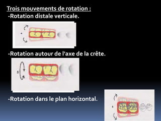 Trois mouvements de rotation :
-Rotation distale verticale.
-Rotation autour de l'axe de la crête.
-Rotation dans le plan horizontal.
 