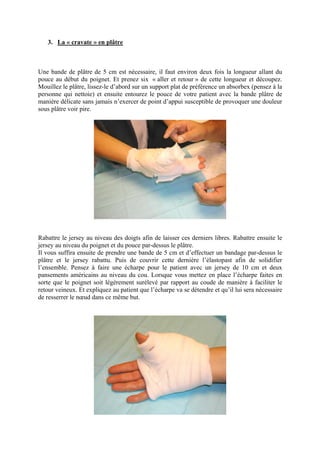 3. La « cravate » en plâtre



Une bande de plâtre de 5 cm est nécessaire, il faut environ deux fois la longueur allant du
pouce au début du poignet. Et prenez six « aller et retour » de cette longueur et découpez.
Mouillez le plâtre, lissez-le d’abord sur un support plat de préférence un absorbex (pensez à la
personne qui nettoie) et ensuite entourez le pouce de votre patient avec la bande plâtre de
manière délicate sans jamais n’exercer de point d’appui susceptible de provoquer une douleur
sous plâtre voir pire.




Rabattre le jersey au niveau des doigts afin de laisser ces derniers libres. Rabattre ensuite le
jersey au niveau du poignet et du pouce par-dessus le plâtre.
Il vous suffira ensuite de prendre une bande de 5 cm et d’effectuer un bandage par-dessus le
plâtre et le jersey rabattu. Puis de couvrir cette dernière l’élastopast afin de solidifier
l’ensemble. Pensez à faire une écharpe pour le patient avec un jersey de 10 cm et deux
pansements américains au niveau du cou. Lorsque vous mettez en place l’écharpe faites en
sorte que le poignet soit légèrement surélevé par rapport au coude de manière à faciliter le
retour veineux. Et expliquez au patient que l’écharpe va se détendre et qu’il lui sera nécessaire
de resserrer le nœud dans ce même but.
 