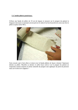 3. L’attelle plâtrée postérieure.


Utiliser une bande de plâtre de 10 cm de largeur et mesurer sur le poignet du patient la
longueur nécessaire en prenant soin de prévoir le rabat d’un bon bourrelet de coton une fois le
plâtre en place (dixit MC).




Faire ensuite sept à huit allers et retour avec la bande plâtrée de façon à donner l’épaisseur
désirée au plâtre. Mouiller ce dernier et enfin lisser celui-ci sur le poignet du patient en
respectant comme toujours la forme naturelle du poignet sans appliquer de point de pression
mais est-il utile de le rappeler ?
 
