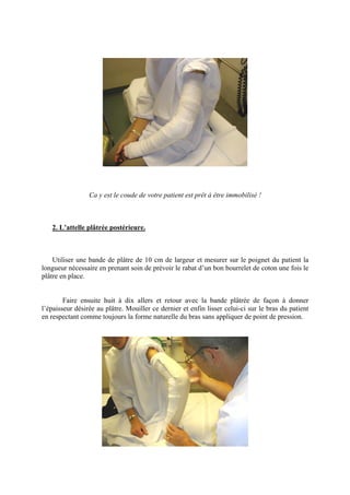 Ca y est le coude de votre patient est prêt à être immobilisé !



   2. L’attelle plâtrée postérieure.



    Utiliser une bande de plâtre de 10 cm de largeur et mesurer sur le poignet du patient la
longueur nécessaire en prenant soin de prévoir le rabat d’un bon bourrelet de coton une fois le
plâtre en place.


        Faire ensuite huit à dix allers et retour avec la bande plâtrée de façon à donner
l’épaisseur désirée au plâtre. Mouiller ce dernier et enfin lisser celui-ci sur le bras du patient
en respectant comme toujours la forme naturelle du bras sans appliquer de point de pression.
 