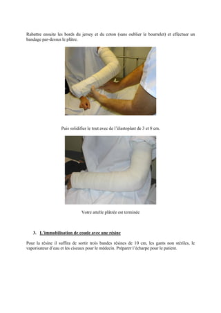 Rabattre ensuite les bords du jersey et du coton (sans oublier le bourrelet) et effectuer un
bandage par-dessus le plâtre.




                   Puis solidifier le tout avec de l’élastoplast de 3 et 8 cm.




                               Votre attelle plâtrée est terminée



   3. L’immobilisation de coude avec une résine

Pour la résine il suffira de sortir trois bandes résines de 10 cm, les gants non stériles, le
vaporisateur d’eau et les ciseaux pour le médecin. Préparer l’écharpe pour le patient.
 