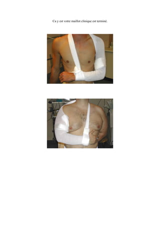 Ca y est votre maillot clinique est terminé.
 