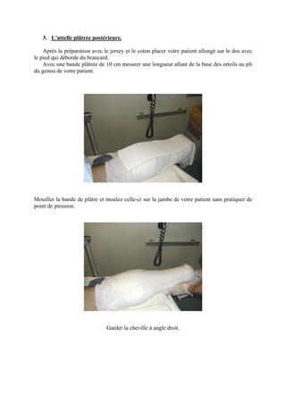 3. L’attelle plâtrée postérieure.

    Après la préparation avec le jersey et le coton placer votre patient allongé sur le dos avec
le pied qui déborde du brancard.
    Avec une bande plâtrée de 10 cm mesurer une longueur allant de la base des orteils au pli
du genou de votre patient.




Mouiller la bande de plâtre et moulez celle-ci sur la jambe de votre patient sans pratiquer de
point de pression.




                               Garder la cheville à angle droit.
 