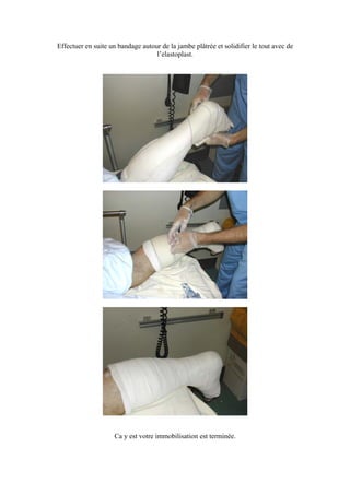 Effectuer en suite un bandage autour de la jambe plâtrée et solidifier le tout avec de
                                   l’elastoplast.




                    Ca y est votre immobilisation est terminée.
 