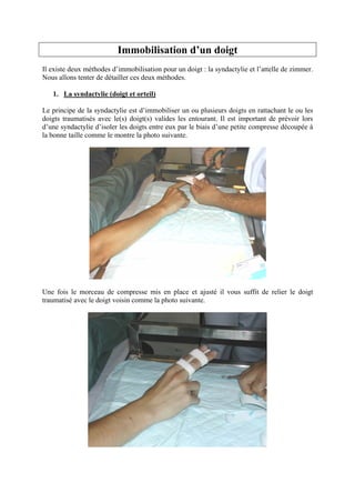 Immobilisation d’un doigt
Il existe deux méthodes d’immobilisation pour un doigt : la syndactylie et l’attelle de zimmer.
Nous allons tenter de détailler ces deux méthodes.

   1. La syndactylie (doigt et orteil)

Le principe de la syndactylie est d’immobiliser un ou plusieurs doigts en rattachant le ou les
doigts traumatisés avec le(s) doigt(s) valides les entourant. Il est important de prévoir lors
d’une syndactylie d’isoler les doigts entre eux par le biais d’une petite compresse découpée à
la bonne taille comme le montre la photo suivante.




Une fois le morceau de compresse mis en place et ajusté il vous suffit de relier le doigt
traumatisé avec le doigt voisin comme la photo suivante.
 
