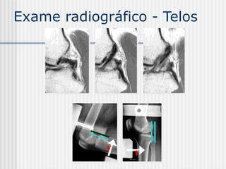 X
F
X
F
Exame radiográfico - Telos
 