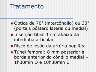 Tratamento
 Óptica de 70° (intercôndilo) ou 30°
(portais póstero lateral ou medial)
 Inserção tibial 1 cm abaixo da
interlinha articular
 Risco de lesão da artéria poplítea
 Túnel femoral: 8 mm posterior à
borda anterior do côndilo medial –
1h30min D e 10h30min E
 
