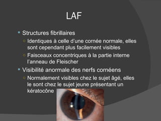 LAF Structures fibrillaires  Identiques à celle d’une cornée normale, elles sont cependant plus facilement visibles Faisceaux concentriques à la partie interne l’anneau de Fleischer Visibilité anormale des nerfs cornéens Normalement visibles chez le sujet âgé, elles le sont chez le sujet jeune présentant un kératocône 