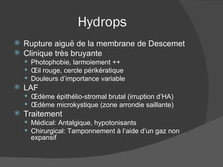 Hydrops Rupture aiguë de la membrane de Descemet Clinique très bruyante Photophobie, larmoiement ++ Œil rouge, cercle périkératique Douleurs d’importance variable LAF Œdème épithélio-stromal brutal (irruption d’HA) Œdème microkystique (zone arrondie saillante) Traitement Médical: Antalgique, hypotonisants Chirurgical: Tamponnement à l’aide d’un gaz non expansif 