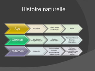 Histoire naturelle 