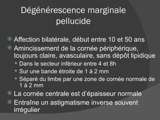 Dégénérescence marginale pellucide Affection bilatérale, début entre 10 et 50 ans Amincissement de la cornée périphérique, toujours claire, avasculaire, sans dépôt lipidique  Dans le secteur inférieur entre 4 et 8h  Sur une bande étroite de 1 à 2 mm Séparé du limbe par une zone de cornée normale de 1 à 2 mm La cornée centrale est d’épaisseur normale Entraîne un astigmatisme inverse souvent irrégulier 
