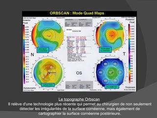 Le topographe Orbscan   Il relève d'une technologie plus récente qui permet au chirurgien de non seulement détecter les irrégularités de la surface cornéenne, mais également de cartographier la surface cornéenne postérieure. 