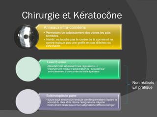 Chirurgie et Kératocône Non réalisés  En pratique 