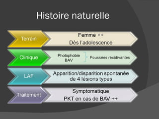 Histoire naturelle Photophobie BAV 