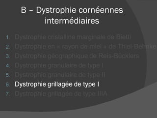 B – Dystrophie cornéennes intermédiaires 