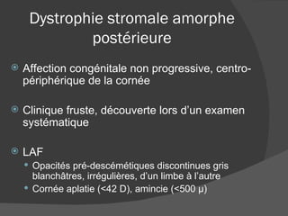 Dystrophie stromale amorphe postérieure Affection congénitale non progressive, centro-périphérique de la cornée Clinique fruste, découverte lors d’un examen systématique LAF Opacités pré-descémétiques discontinues gris blanchâtres, irrégulières, d’un limbe à l’autre Cornée aplatie (<42 D), amincie (<500 µ) 
